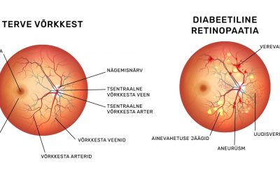 Suhkruhaigusest tingitud diabeetiline retinopaatia